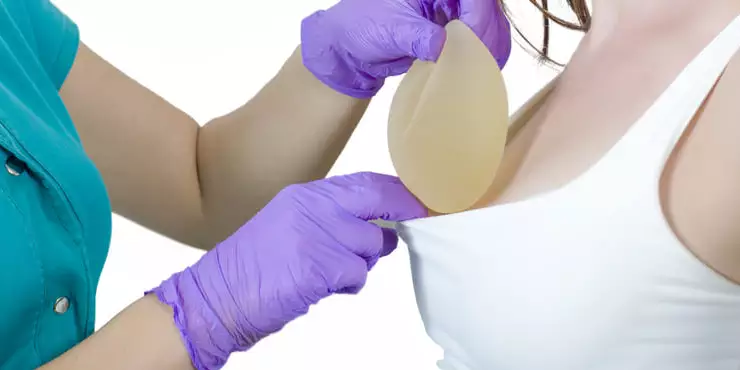  Implante de silicone